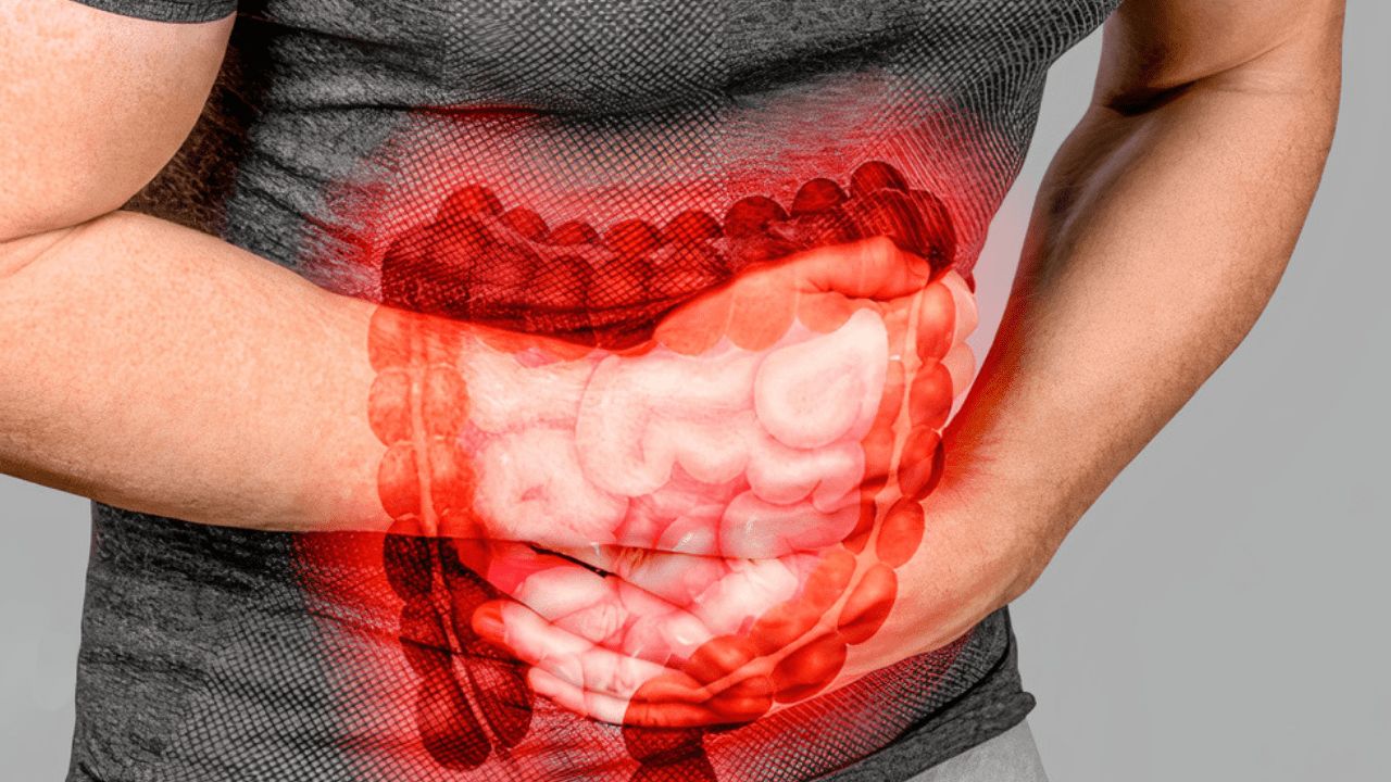 Bağırsak Endometriozisinde Kabızlık ve İshal Sorunları